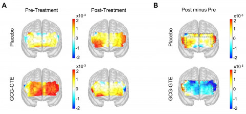 논문 삽입 이미지 - 시험 수행 전후 뇌의 활성도, 에너지 소비 변화